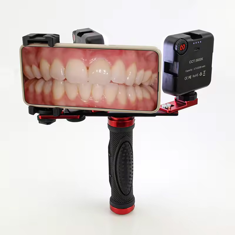 Photography Lighting Lamp - 歯科用モバイル写真撮影LEDライト 口腔内写真・ビデオ用フラッシュライト 照明器具 歯科医治療用ランプ